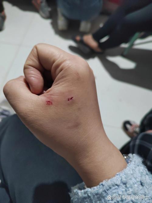 家猫咬破皮没出血青了