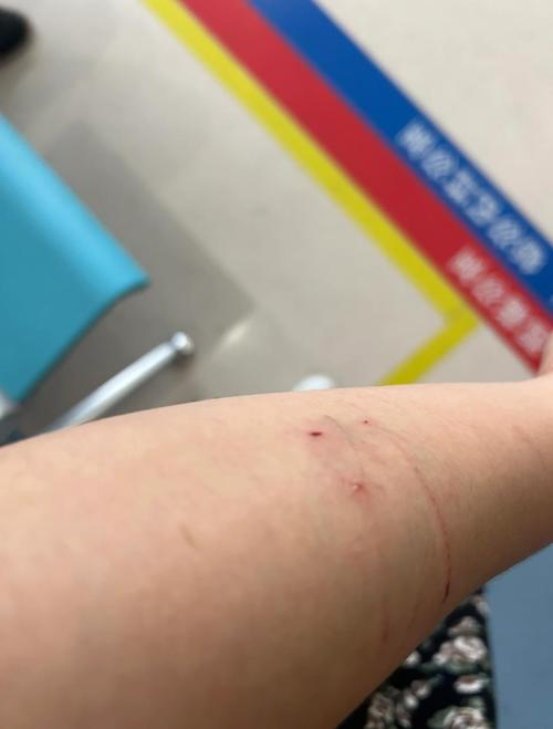 被猫抓破皮了没出血