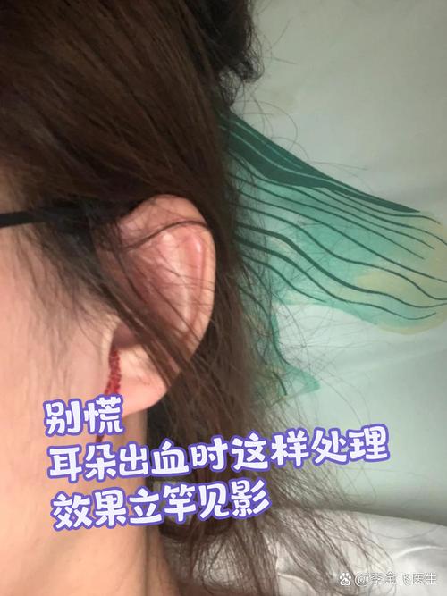 狗的耳朵破了怎么办啊