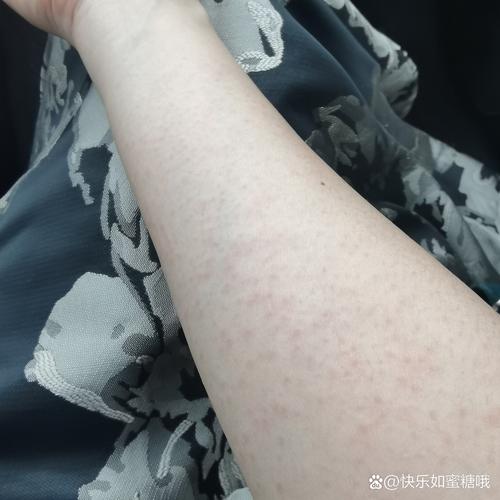 狗吃了海鲜怎么解决