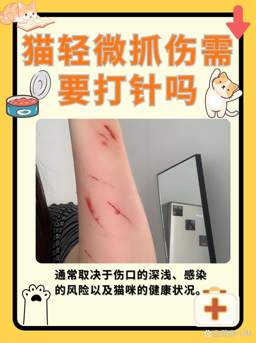 被猫抓了一下轻微破皮要打针吗