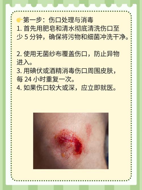 被猫抓了一下轻微破皮要打针吗