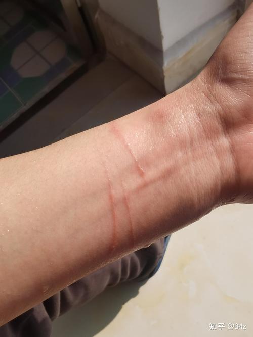 猫抓破了一点皮需要打狂犬疫苗吗