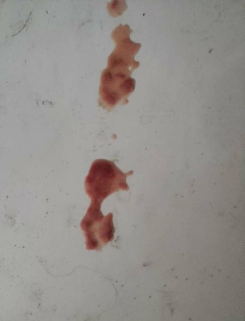 狗狗不吃东西拉黑色稀屎的治疗方法