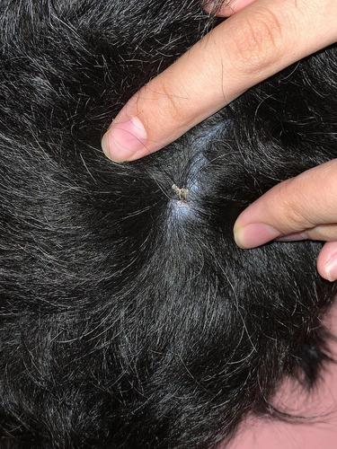 狗狗为什么会有疤印子