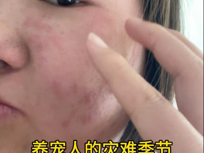 人对狗狗过敏的症状有哪些?