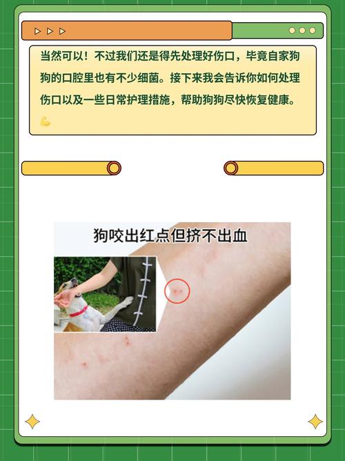 被自家狗咬了出血不打针行吗