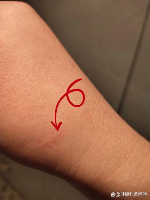 ...咬了下,没破皮没流血,只有一点牙齿印,需要打针吗