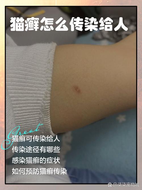 人发烧会传染给猫咪吗