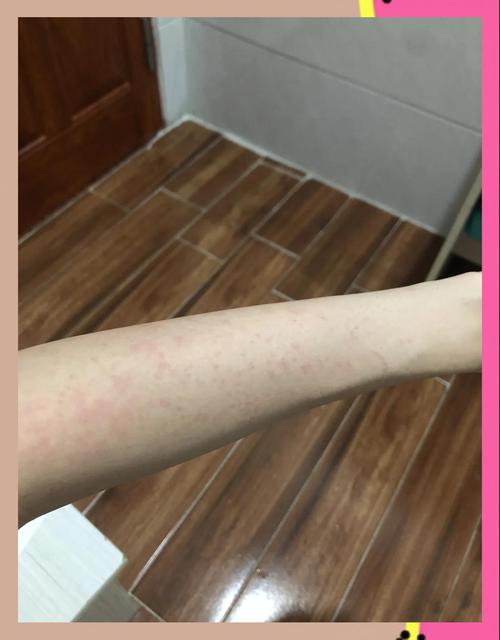 养猫多久会发现对猫过敏