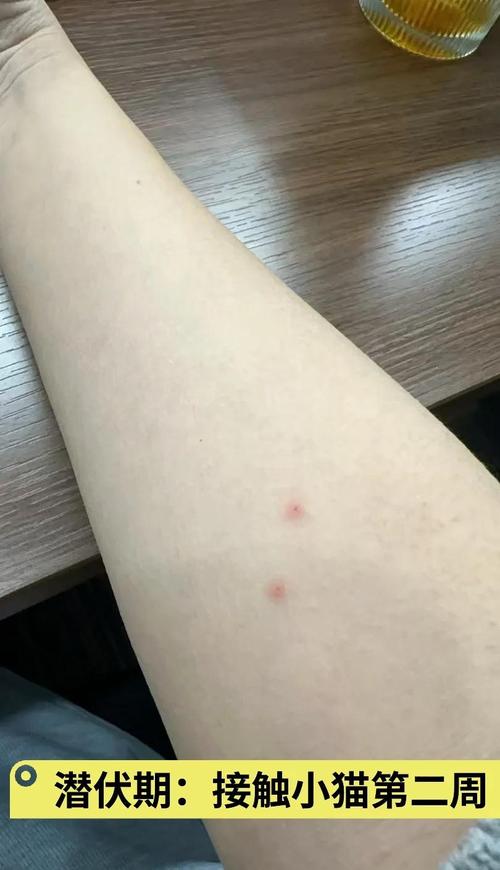 对猫过敏多久会有过敏症状