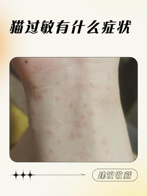 对毛猫过敏的症状