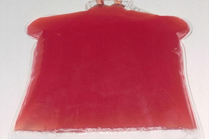 狗狗腹水为什么是血水