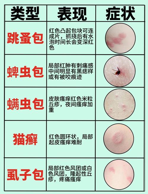 猫咪可能会传染给人哪些疾病