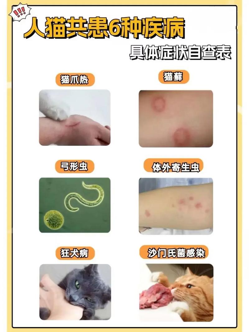 猫咪能传染人的四种疾病
