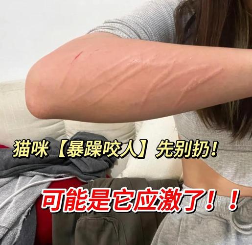 猫咪突然变得很狂躁攻击人是为什么