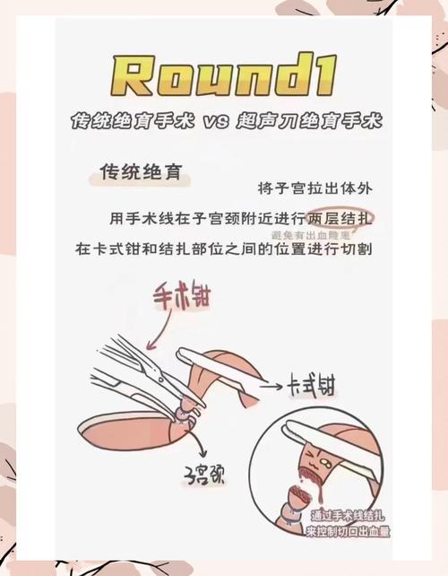 母猫绝育手术步骤