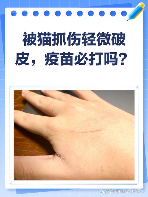 被自家养的猫咪挠伤咬伤需要打狂犬疫苗吗?