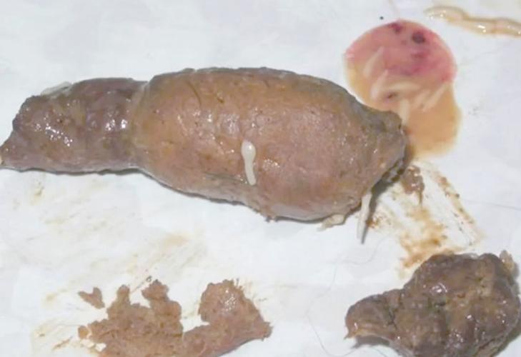 猫咪有这些症状,很可能体内有寄生虫啦