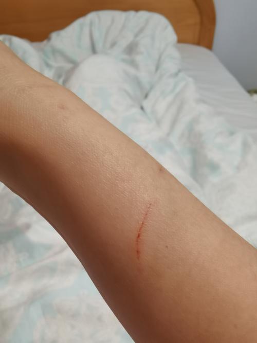 猫抓破了一点皮需要打狂犬疫苗吗