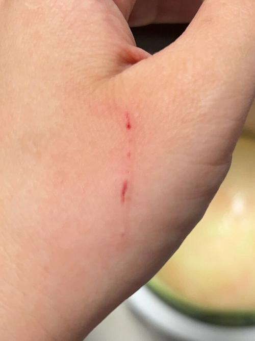 被家养猫抓伤轻微出血要打针吗