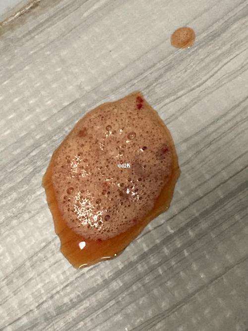 ...小时候疫苗都打过了,最近发现上吐下泻还拉血水,是怎么回事...