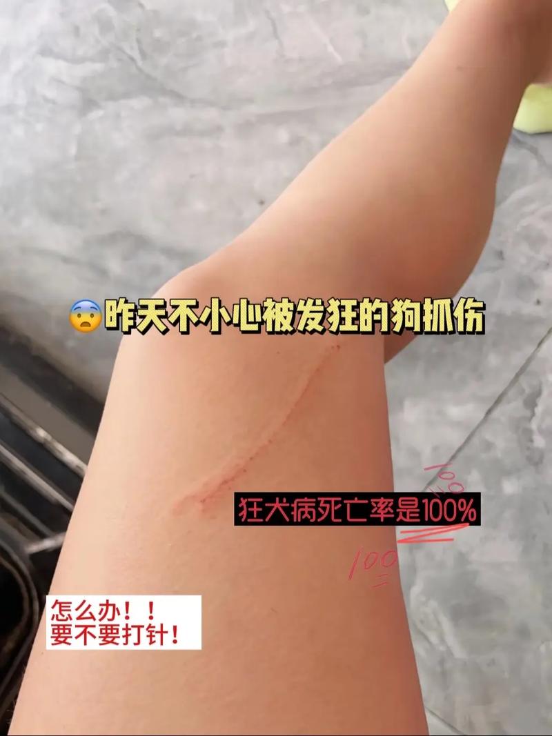 小狗狗把自己脸挠伤了可以贴创可贴吗