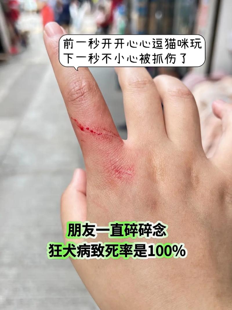 手被猫咪抓出血了怎么办