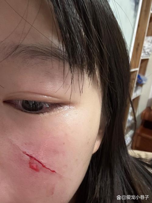猫咪把自己脑袋挠出血