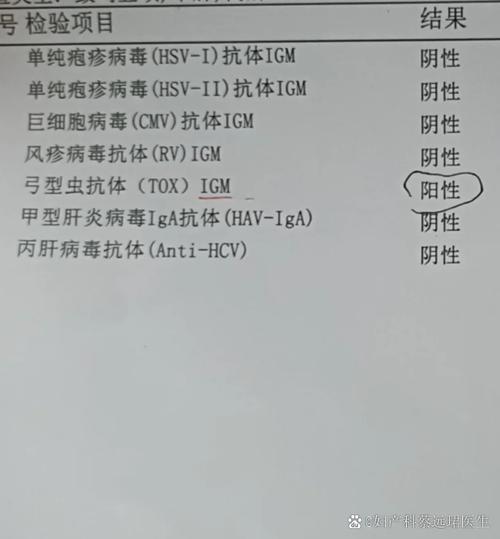 养狗感染弓形虫几率